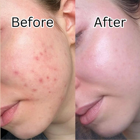 Dr. Althea 345 Relief Cream 50ml - Avoriell