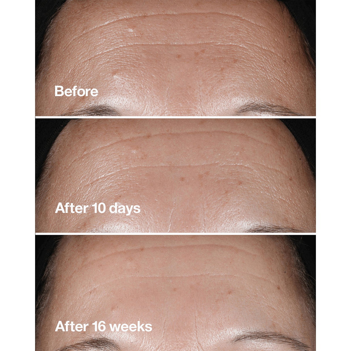 Clinique Smart Clinical Repair Wrinkle Correcting Serum 50 ml - Avoriell