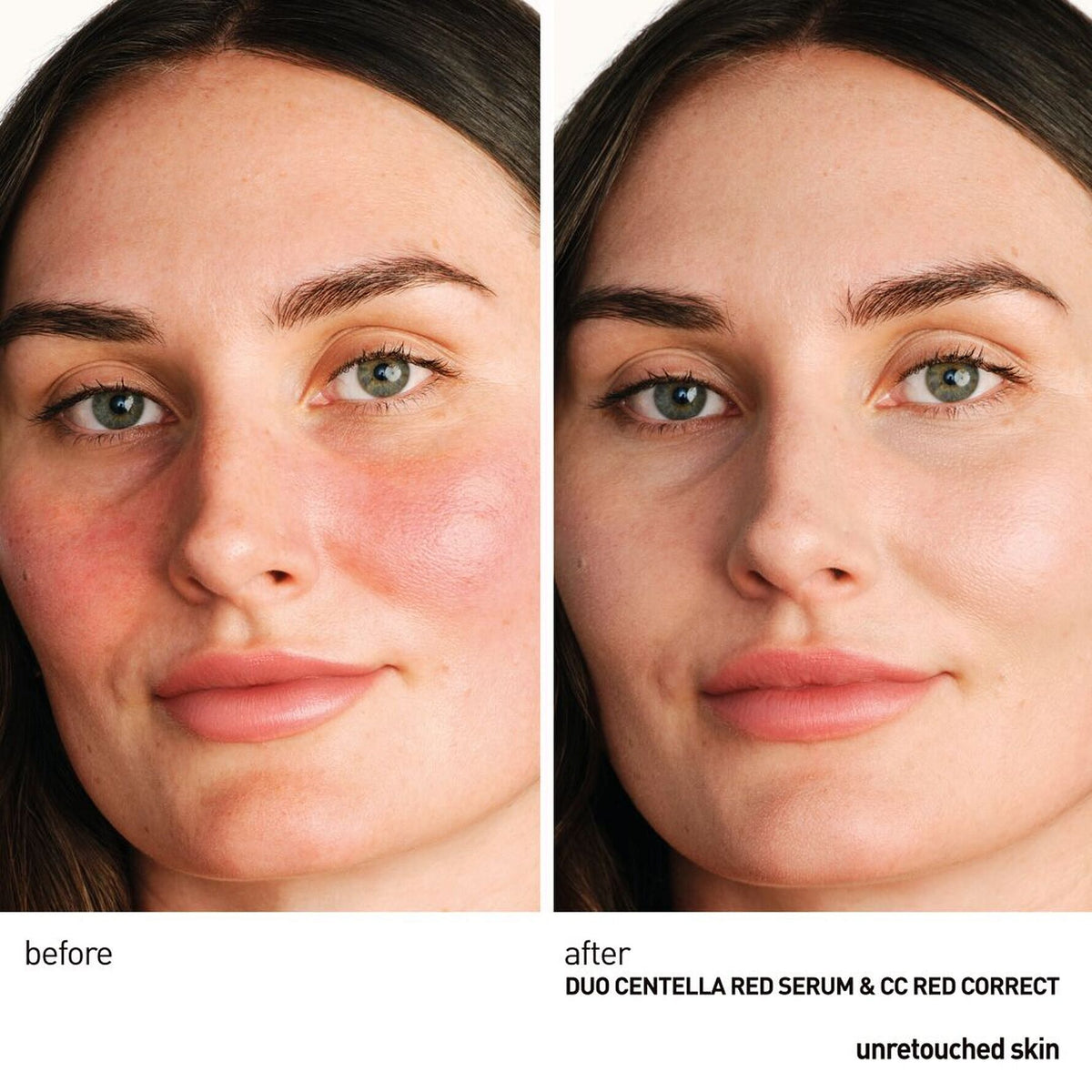 Erborian Red Serum resultat på känslig hud i ansiktet före och efter