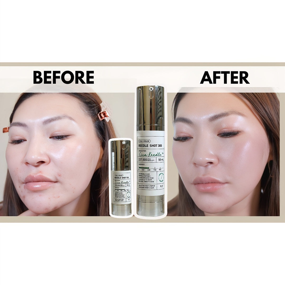 VT Cosmetics VT Reedle Shot 300 50ml