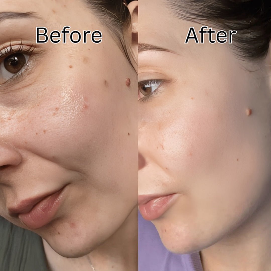 Anua Niacinamide 10% TXA 4% Dark Spot Removing Serum 30ml - Avoriell