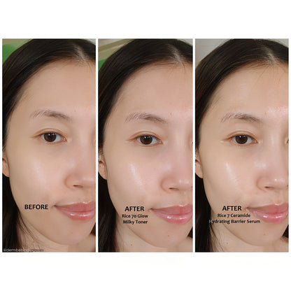 Anua 7 Rice Ceramide Hydrating Barrier Serum 50ml