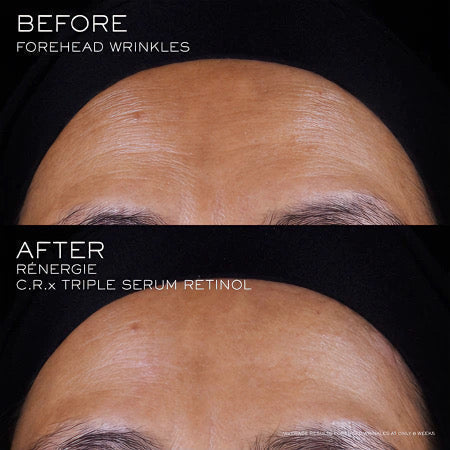 Lancome Renergie Crx Retinol Triple Serum 50ml