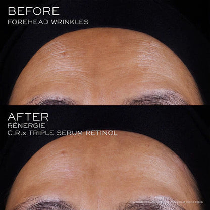 Lancome Renergie Crx Retinol Triple Serum 50ml