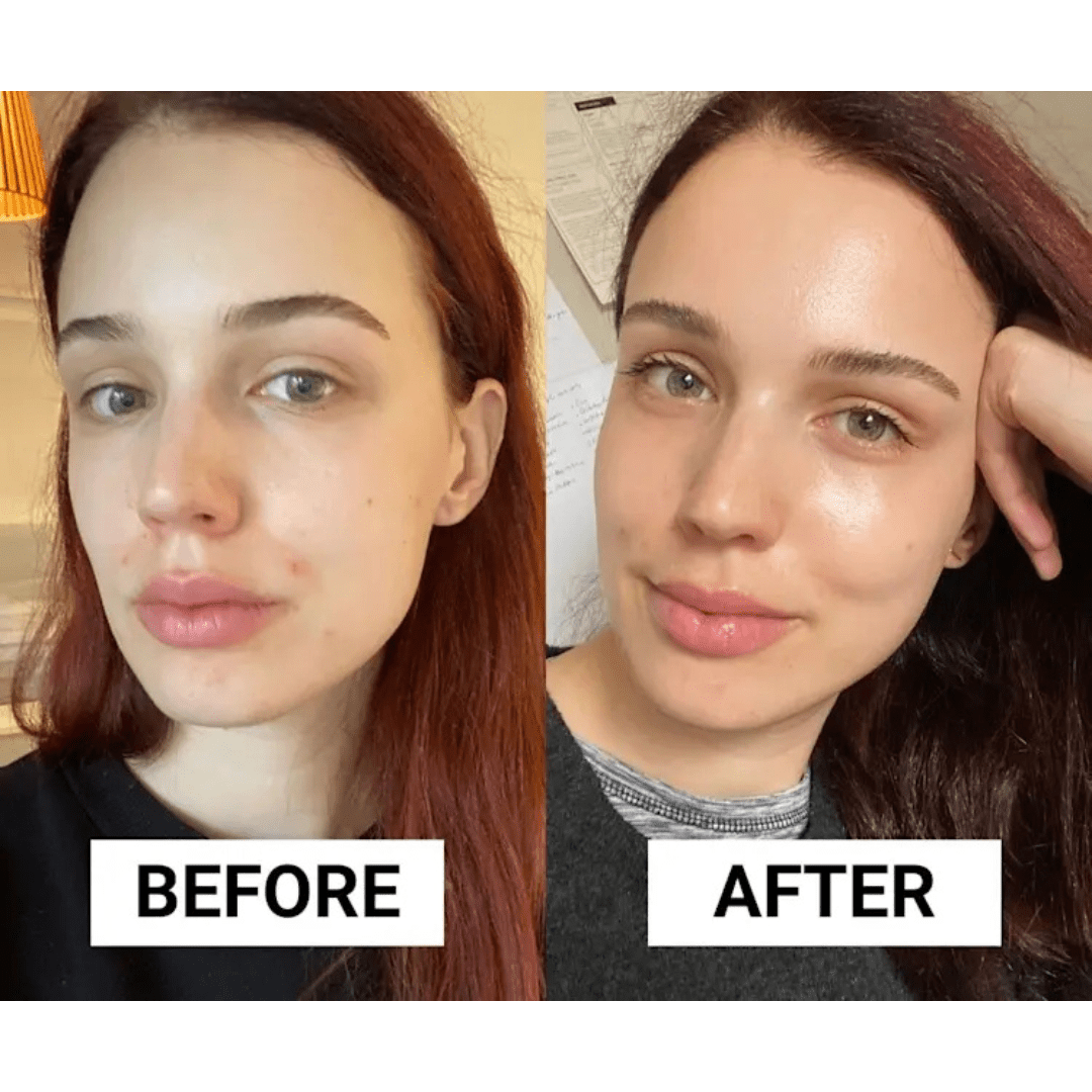 La Roche Posay Effaclar Duo + M 40ml - Avoriell